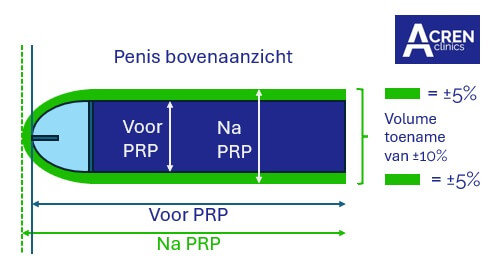 p-shots