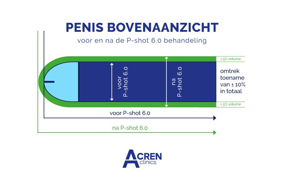 p-shot resultaten